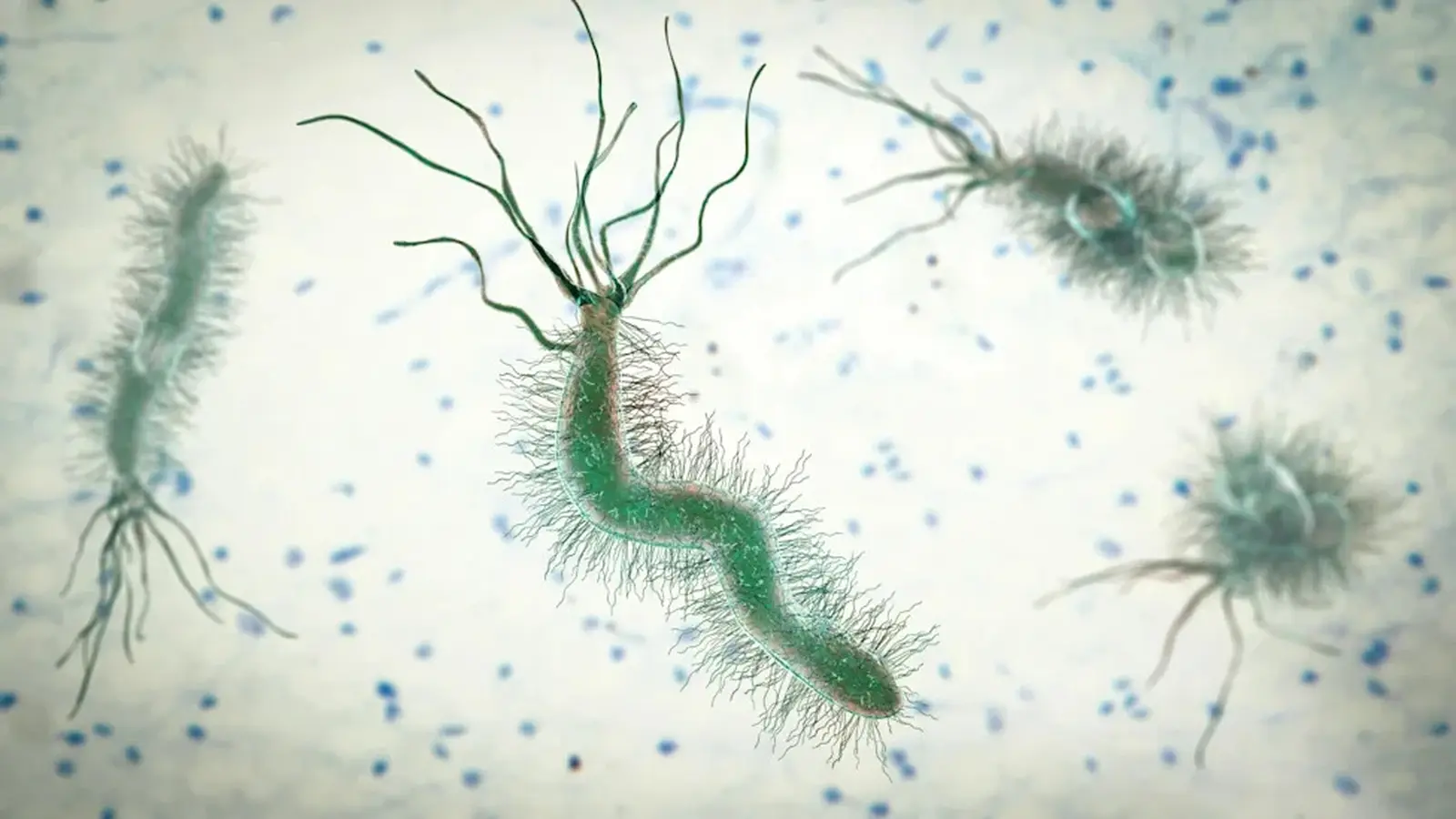 Five Infections Behind Millions of Global Cancer Cases