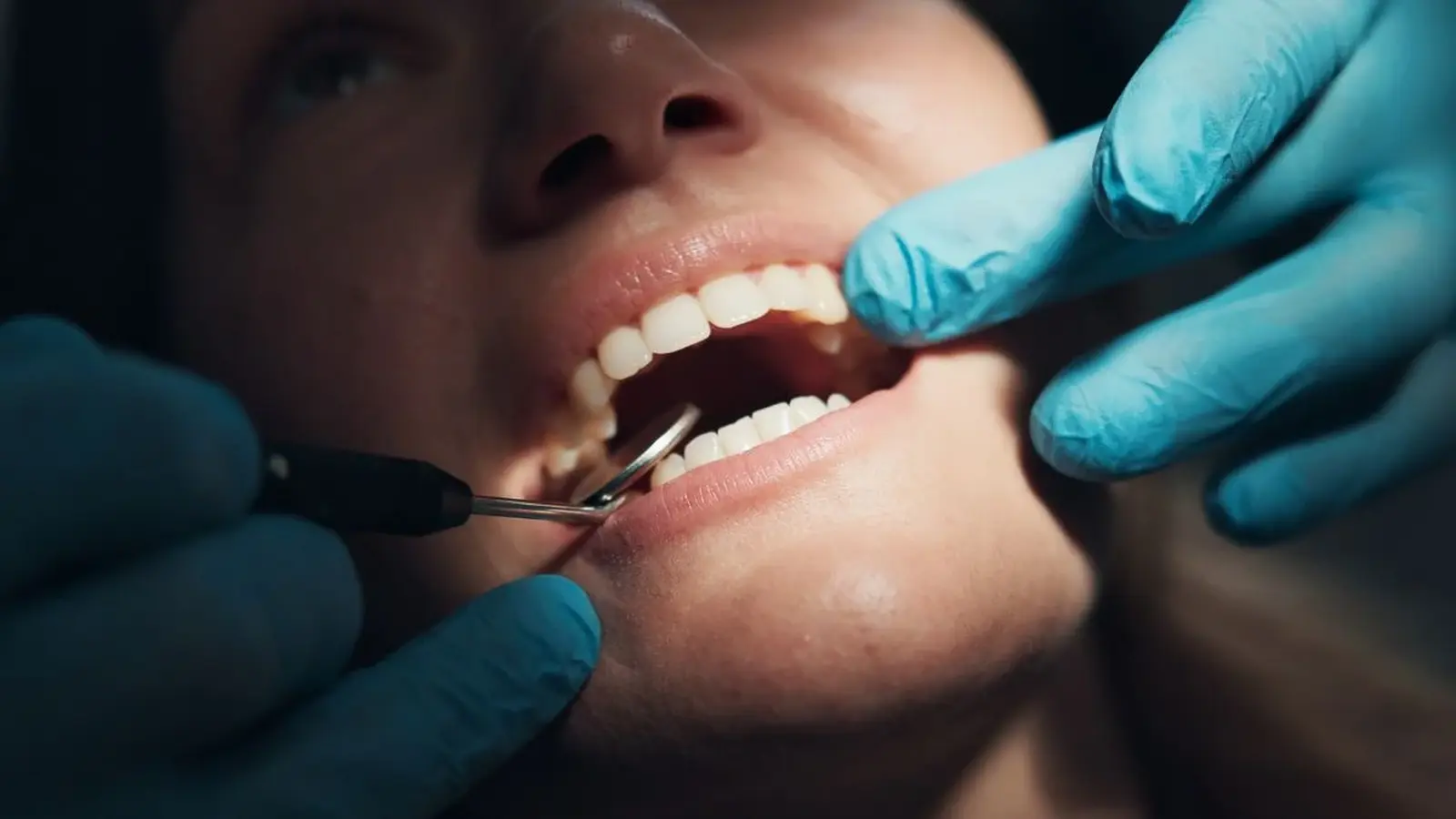 Bleeding Gums Linked to Higher Alzheimer's Risk, Study