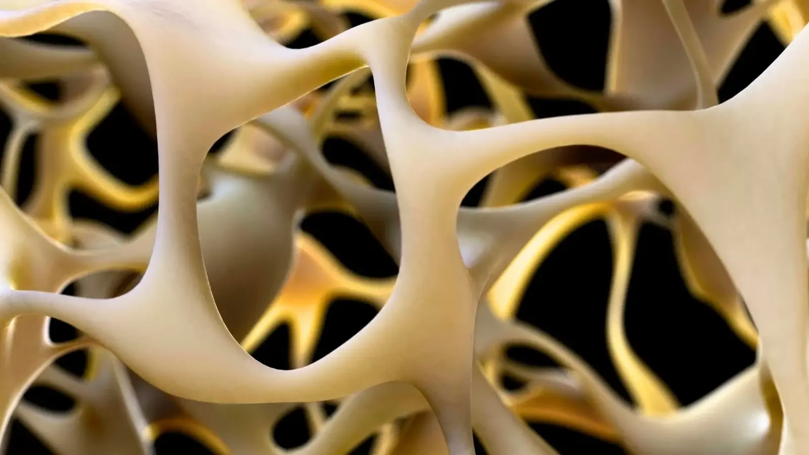Edited Stem Cells Rebuild Bone in Advanced Osteoporosis