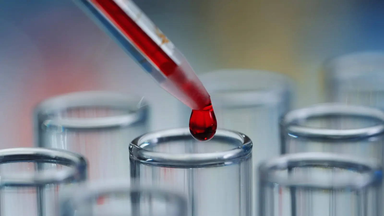 PANXEON: A New Blood Test to Detect Early Pancreatic Cancer