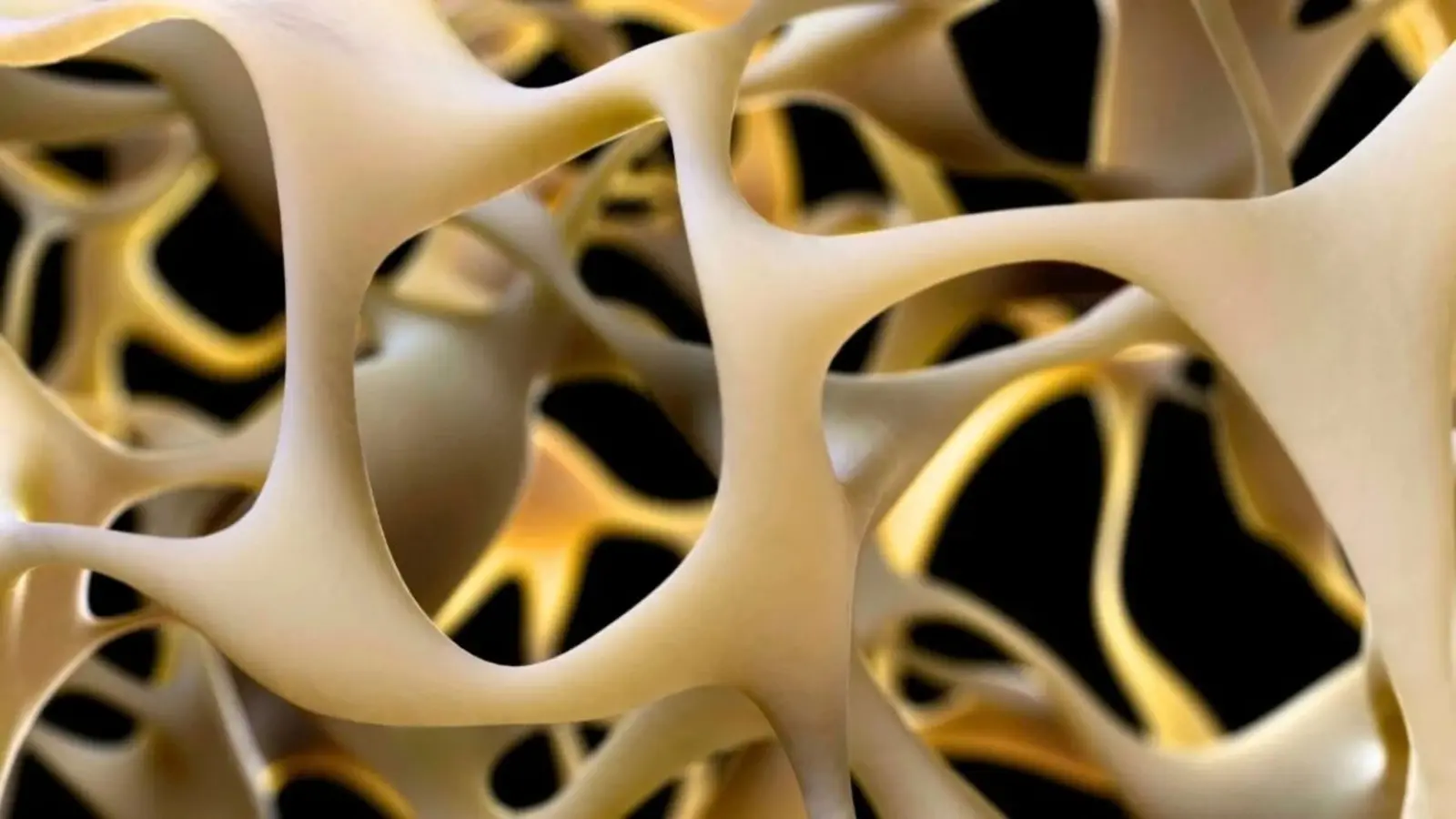 High Blood Pressure May Drive Osteoarthritis Progression