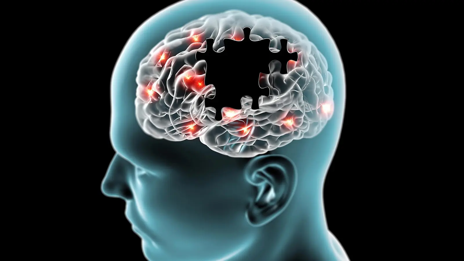 Transplant Drug Boosts Brain Blood Flow in APOE4 Carriers
