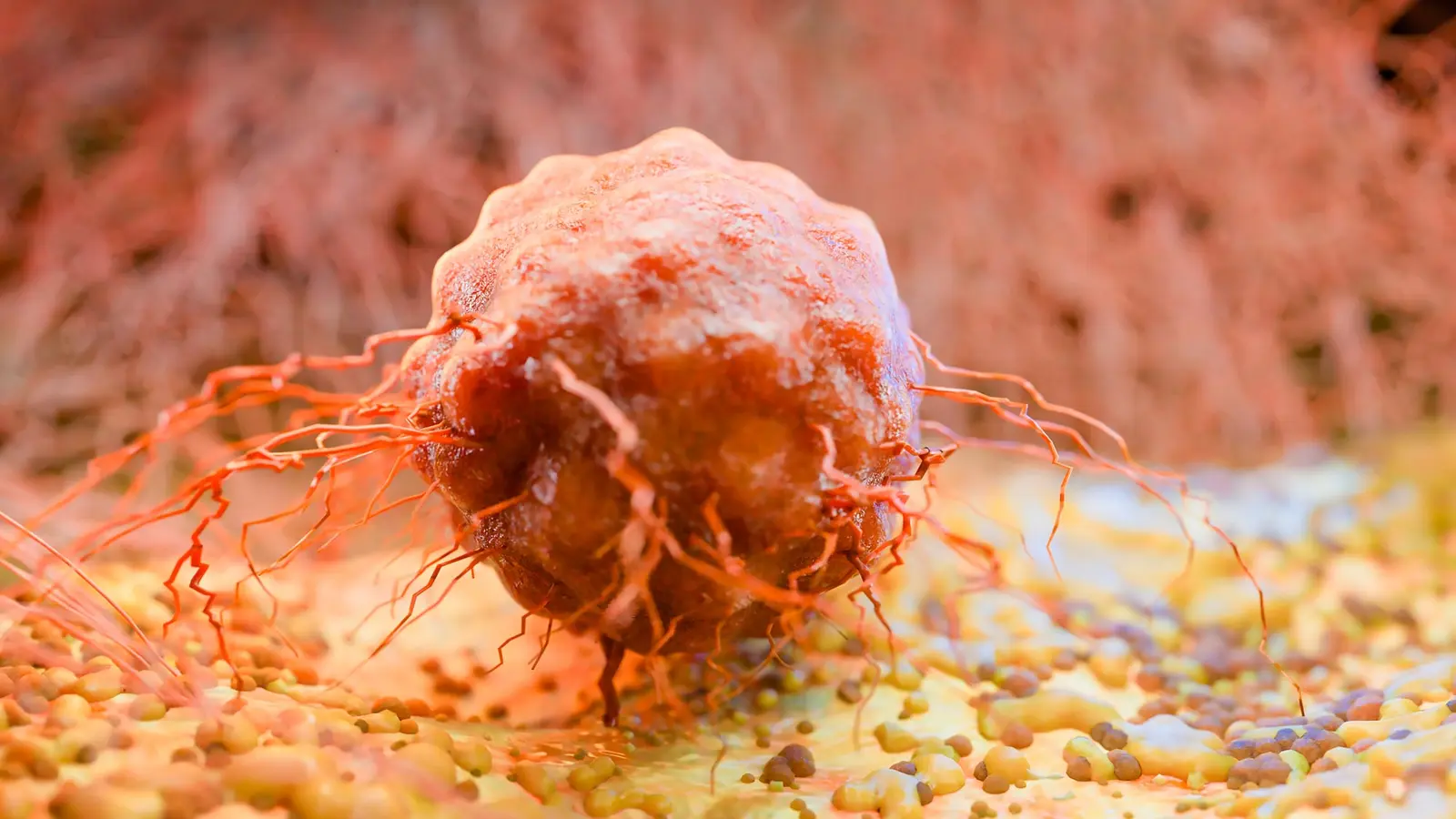 Gut Microbes May Predict Cancer Outcomes and Chemo Effects