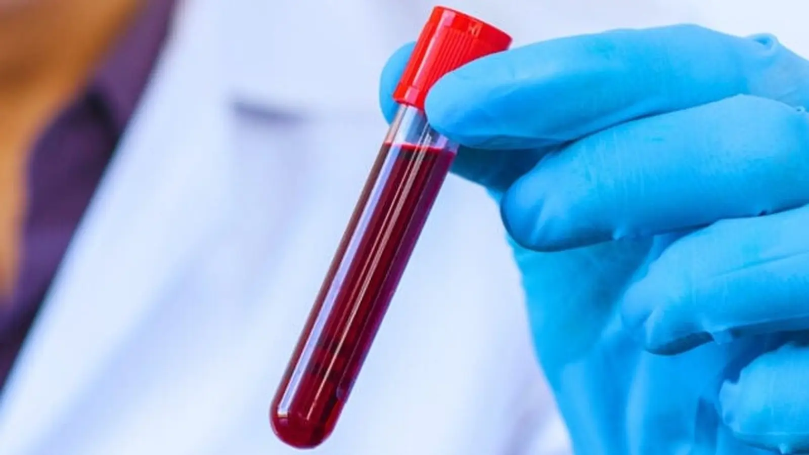 Monocyte Aging Points to a Promising Depression Test